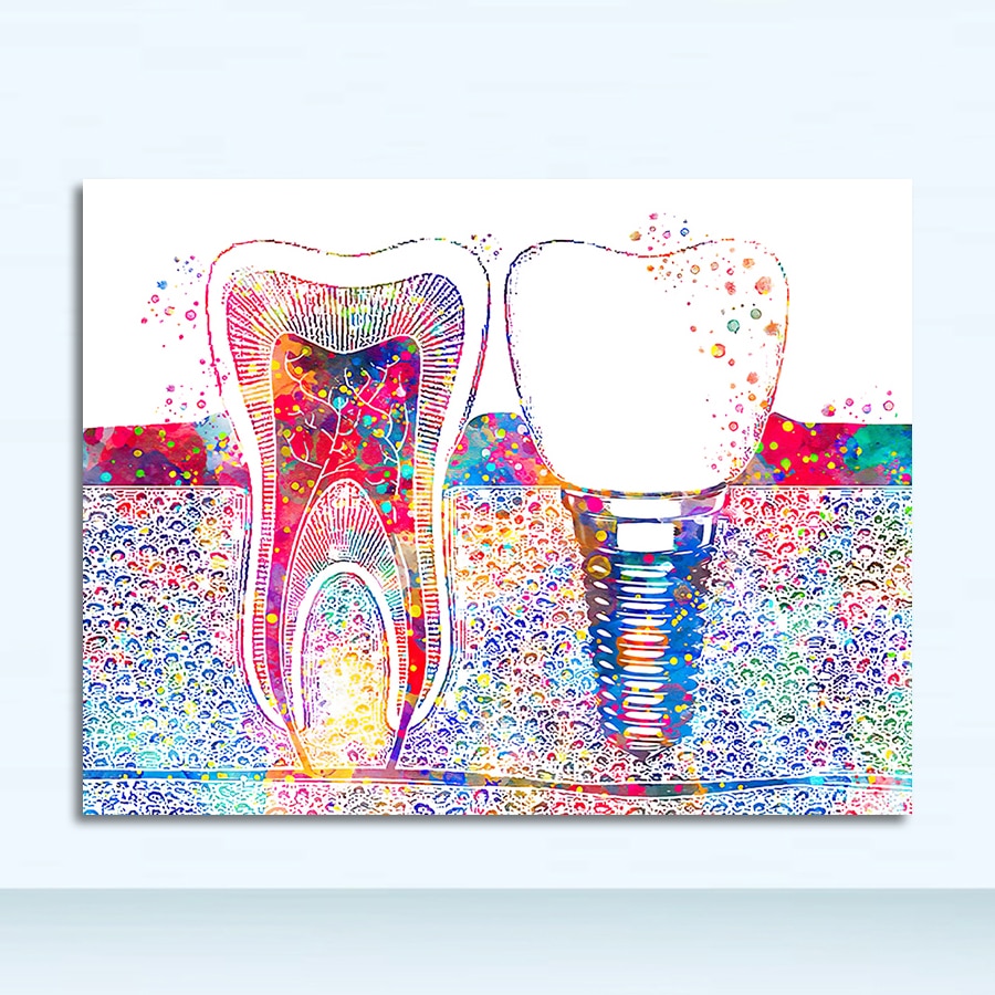 Wall Art Painting Medicine Hygienist Poster Tooth Watercolor Clinic Decor Dental Art Picture Tooth Implant Canvas Print Dentist